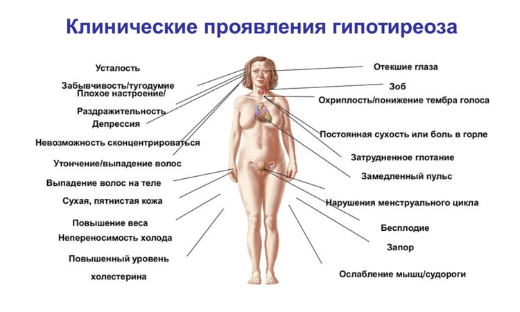 Як лікувати гіпотиреоз щоб уникнути наслідків?