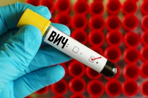 Чи можна повторно захворіти на вітрянку: вдруге можливий?