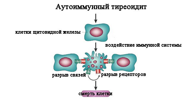Аутоімунний тиреоїдит перетікающій в гіпотиреоз: як бути?