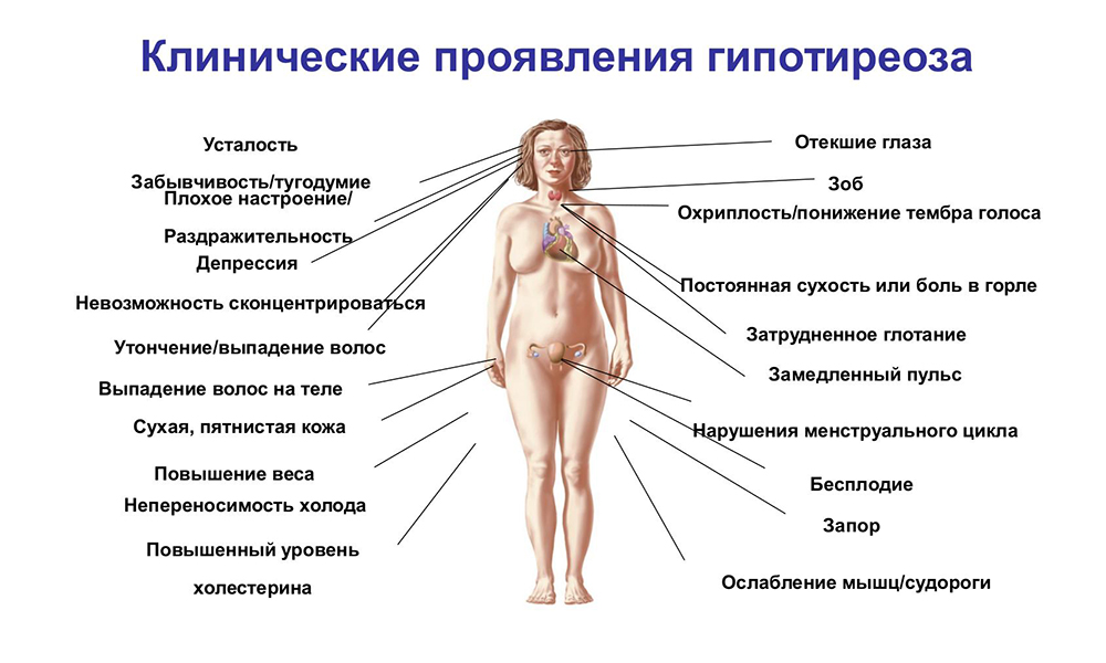 Які аналізи потрібно здати при гіпотиреозі? Які аналізи потрібно здати при гіпотиреозі?
