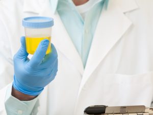 Лейкоцитурия: причини підвищених лейкоцитів у жінок