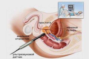 Норми ультразвукового дослідження сечового міхура