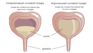 Норми ультразвукового дослідження сечового міхура