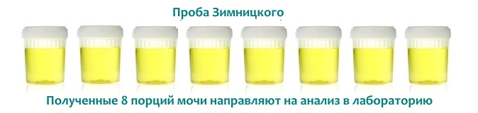 Збір сечі на пробу Зимницкого
