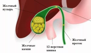 Ультразвукове дослідження жовчного міхура