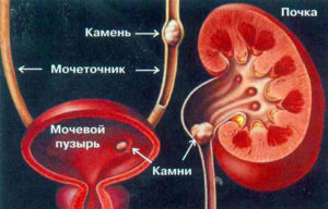 УЗД діагностика нирок і сечового міхура
