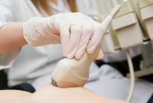 УЗД вагітних з доплером (доплерографія)