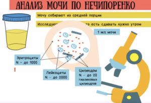 Причини сечовипускання з кров'ю у жінок