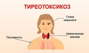 Чим небезпечна тахікардія і як її лікувати?