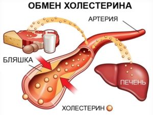 Користь і шкода статинів при лікуванні підвищеного холестерину