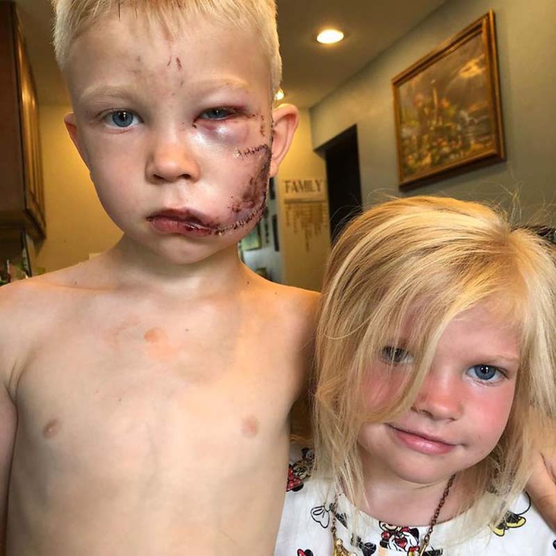 6-летний паренёк спас сестру от нападения собаки, получив при этом 90 швов и похвалу от героев мирового блокбастера про мстителей 6-летний паренёк спас сестру от нападения собаки, получив при этом 90 швов и похвалу от героев мирового блокбастера про мстителей