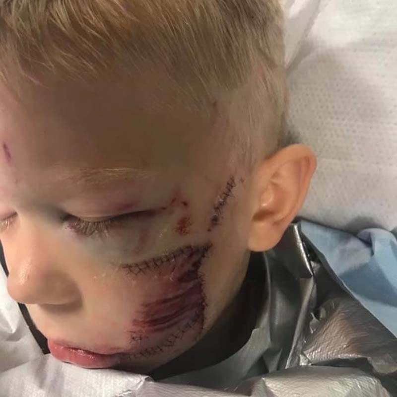 6-летний паренёк спас сестру от нападения собаки, получив при этом 90 швов и похвалу от героев мирового блокбастера про мстителей 6-летний паренёк спас сестру от нападения собаки, получив при этом 90 швов и похвалу от героев мирового блокбастера про мстителей