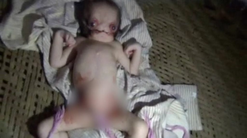 В Індії народилася дитина-мутант, якого місцеві жителі прозвали «чужим»