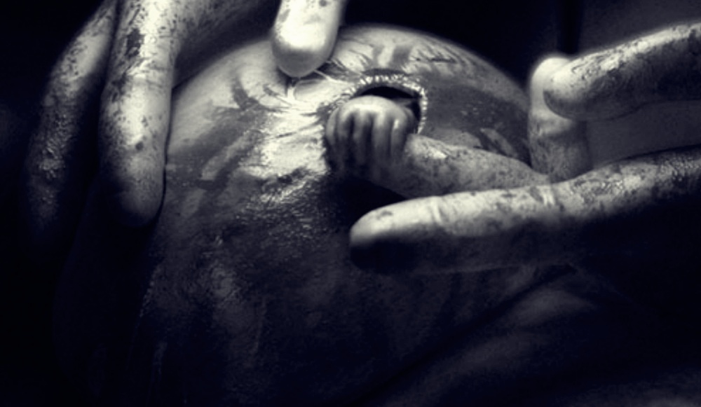 Що трапилось із малюком зі знаменитої на весь світ фотографії «Рука надії»?